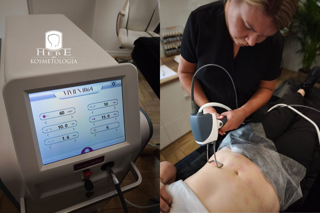 Specjalistka przeprowadza konsultację z klientką przed zabiegiem modelowania sylwetki.