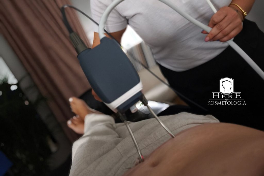 Urządzenie do liposukcji laserowej Vivien 1064 nm w Gabinecie Hebe.
