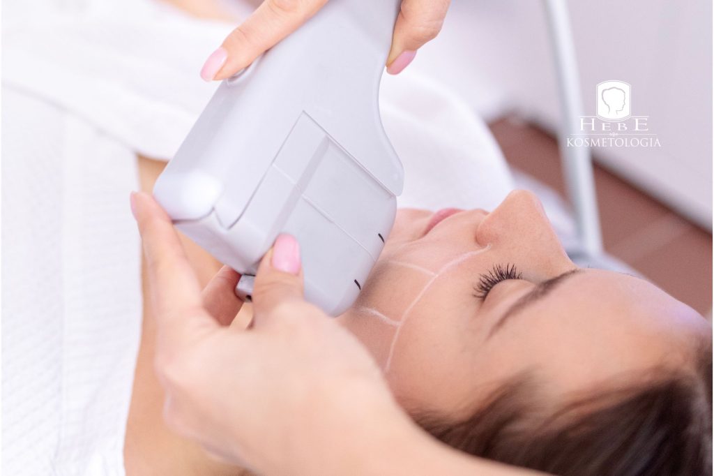 podczas zabiegu liftingu HIFU w Młąwie