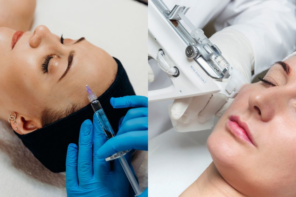 klasyczna mezoterapia vs. Vital Injector Mława.