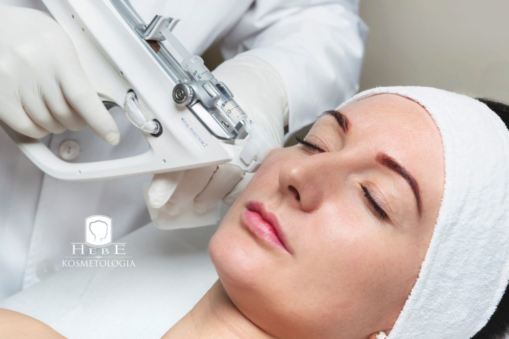 Głowica do mezoterapii wieloigłowej próżniowej podczas pracy na skórze.