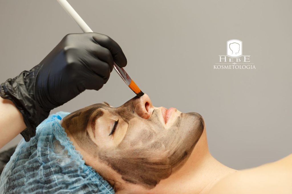 nakładanie maski węglowej do peelingu laserowego